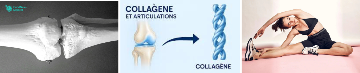 Les bienfaits du collagène sur les articulations